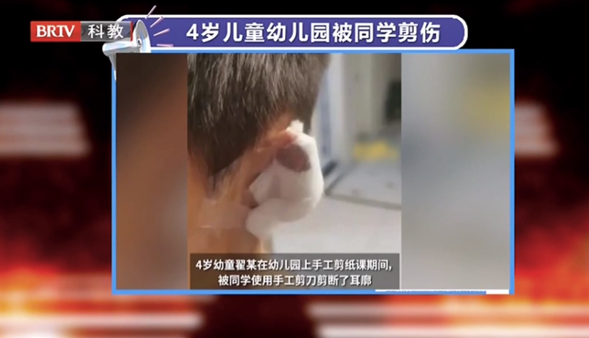 京云律師解讀：4歲兒童課堂上被同學剪斷耳廓，法院：幼兒園全責